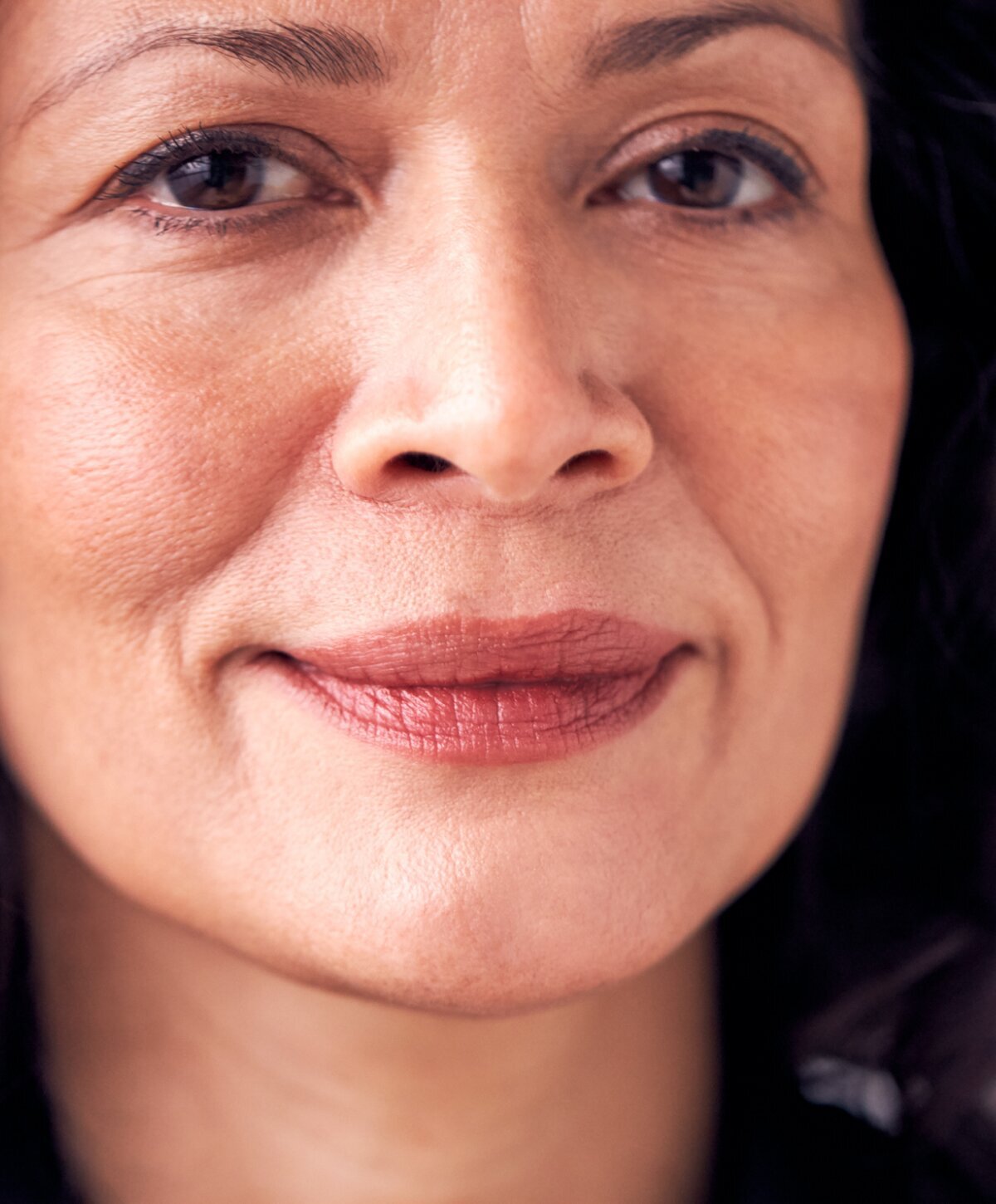 Beverly Hills Fractional Laser model smiling with brown hair